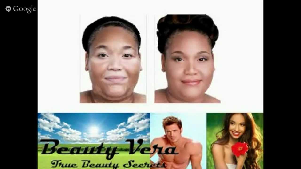 Vitiligo Treatment